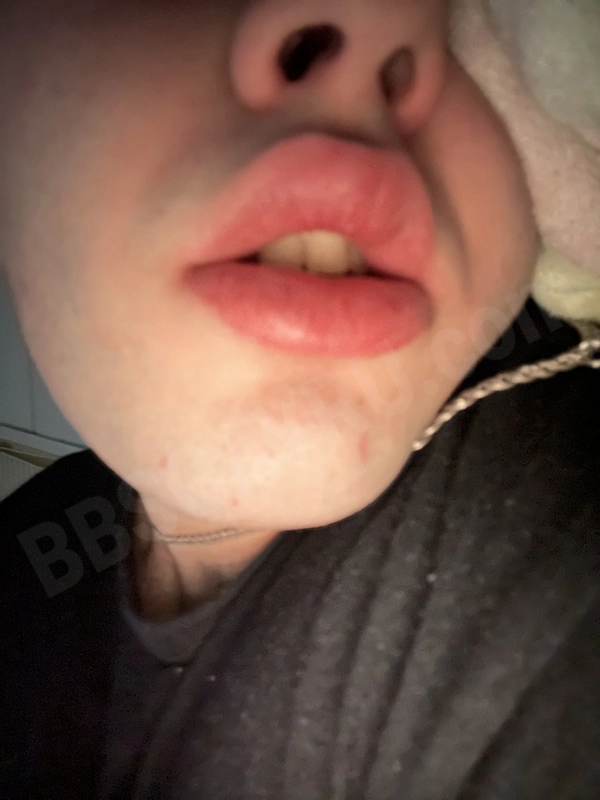 dim7779034614697